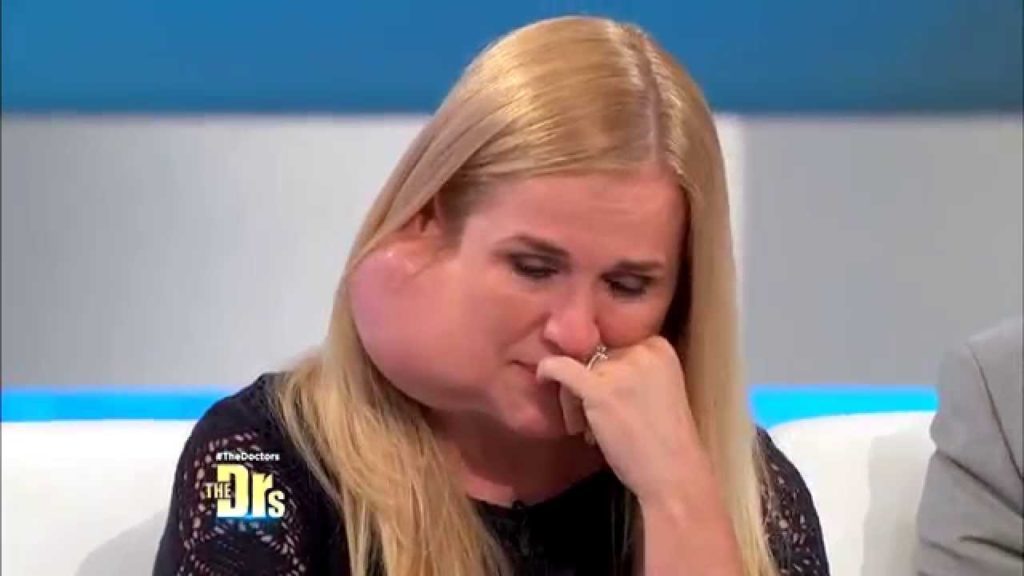 Mom notices a lump behind her ear while combing her hair. Months later, it kept getting bigger