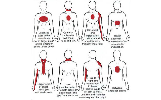 does all my patients all have chest pain