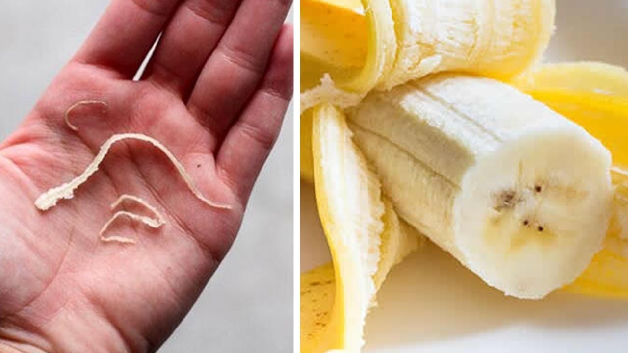 Turns Out Those Annoying Little Strings On Bananas Have A Name — And A